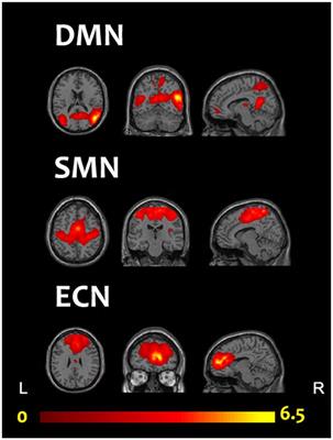Effects of the 2-Repeat Allele of the DRD4 Gene on Neural Networks Associated With the Prefrontal Cortex in Children With ADHD